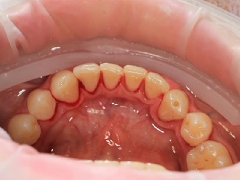 example of healthy teeth after 