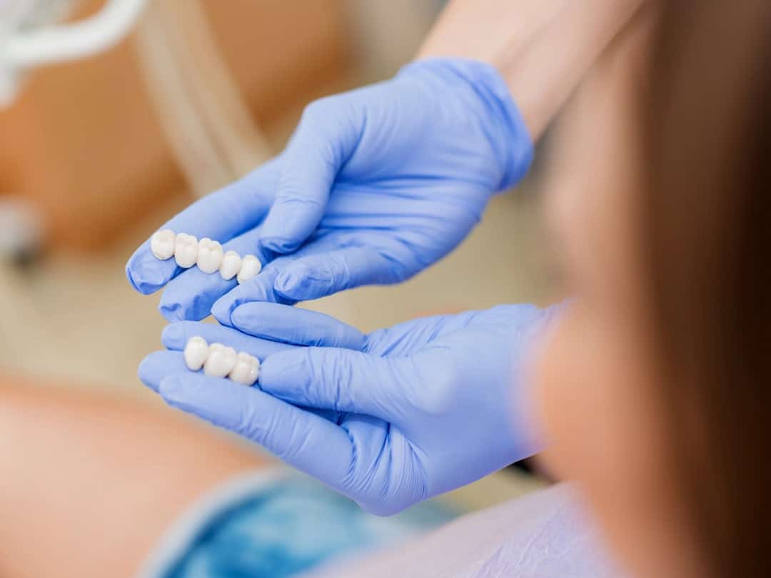 Dentist showing various dental implants to patient